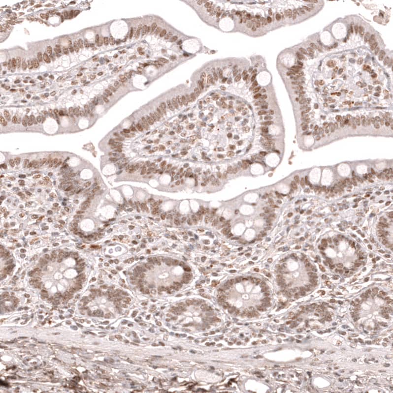 Staining of human small intestine shows moderate nuclear positivity in glandular cells.