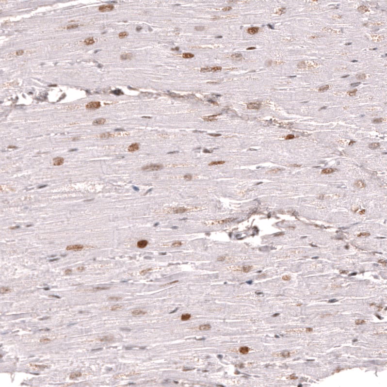 <b>Orthogonal Strategies Validation. </b>Staining of human heart muscle shows moderate to strong nuclear positivity in cardiomyocytes.