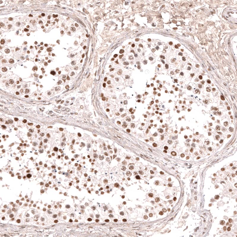 Staining of human testis shows moderate to strong nuclear positivity in cells in seminiferous ducts.