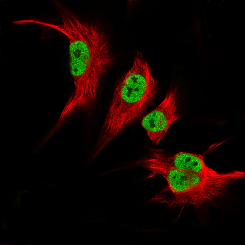 Staining in U-251MG cell line showing specific staining of nucleoplasm in green. Microtubule- and nuclear probes are visualized in red and blue respectively (where available).