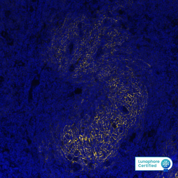 embedded sections of human Hodgkin's Lymphoma using Mouse Anti-Human CD21, Monoclonal Antibody (Catalog # NBP3-26866) at 1:800 at 37° Celsius for 4 minutes. Before incubation with the primary antibody, tissue underwent an all-in-one dewaxing and antigen retrieval preprocessing using PreTreatment Module (PT Module)and Dewax and HIER Buffer H (pH 9; Epredia Catalog #TA-999-DHBH). Tissue was stained using the Alexa Fluor™ 647 Goat anti-Mouse IgG Secondary Antibody at 1:200 at 37 ° Celsius for 2 minutes. (Yellow; Lunaphore Catalog # DR647MS) and counterstained with DAPI (blue; Lunaphore Catalog # DR100). Specific staining was localized to the membrane. Protocol available in COMET™ Panel Builder.
