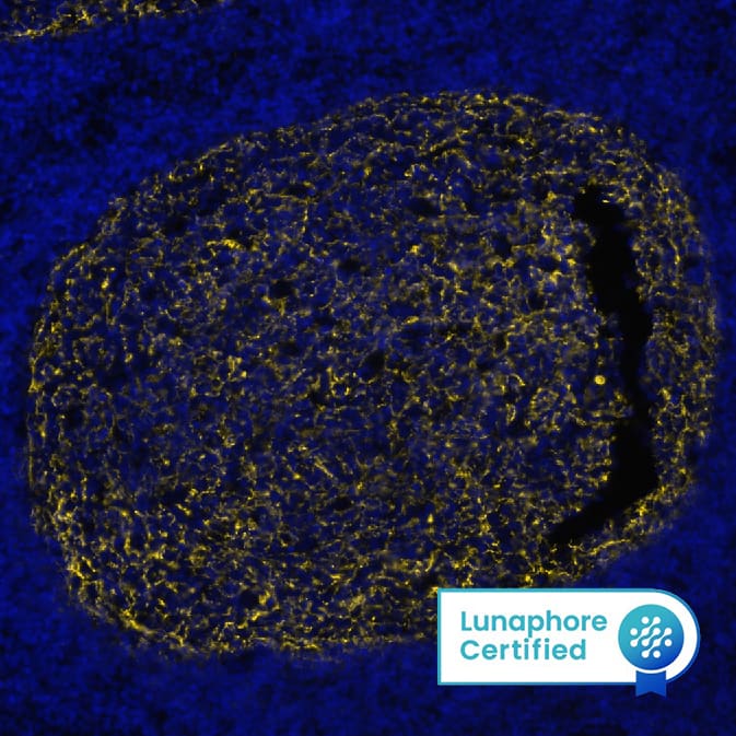 CD21 was detected in immersion fixed paraffin-embedded sections of human Lymph Node using Mouse Anti-Human CD21, Monoclonal Antibody (Catalog # NBP3-26866) at 1:800 at 37° Celsius for 4 minutes. Before incubation with the primary antibody, tissue underwent an all-in-one dewaxing and antigen retrieval preprocessing using PreTreatment Module (PT Module)and Dewax and HIER Buffer H (pH 9; Epredia Catalog #TA-999-DHBH). Tissue was stained using the Alexa Fluor™ 647 Goat anti-Mouse IgG Secondary Antibody at 1:200 at 37 ° Celsius for 2 minutes. (Yellow; Lunaphore Catalog # DR647MS) and counterstained with DAPI (blue; Lunaphore Catalog # DR100). Specific staining was localized to the membrane. Protocol available in COMET™ Panel Builder.