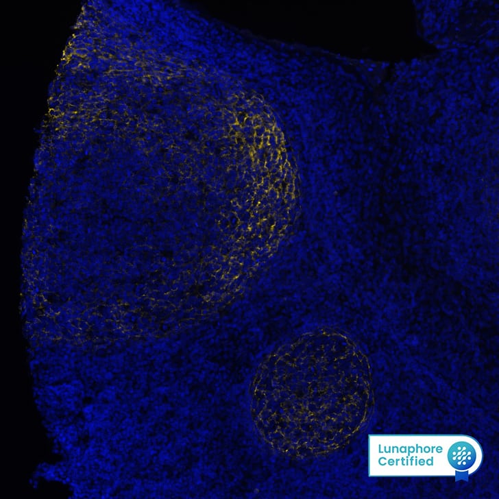 CD21 was detected in immersion fixed paraffin-embedded sections of human Tonsil using Mouse Anti-Human CD21, Monoclonal Antibody (Catalog # NBP3-26866) at 1:800 at 37° Celsius for 4 minutes. Before incubation with the primary antibody, tissue underwent an all-in-one dewaxing and antigen retrieval preprocessing using PreTreatment Module (PT Module)and Dewax and HIER Buffer H (pH 9; Epredia Catalog #TA-999-DHBH). Tissue was stained using the Alexa Fluor™ 647 Goat anti-Mouse IgG Secondary Antibody at 1:200 at 37 ° Celsius for 2 minutes. (Yellow; Lunaphore Catalog # DR647MS) and counterstained with DAPI (blue; Lunaphore Catalog # DR100). Specific staining was localized to the membrane. Protocol available in COMET™ Panel Builder.