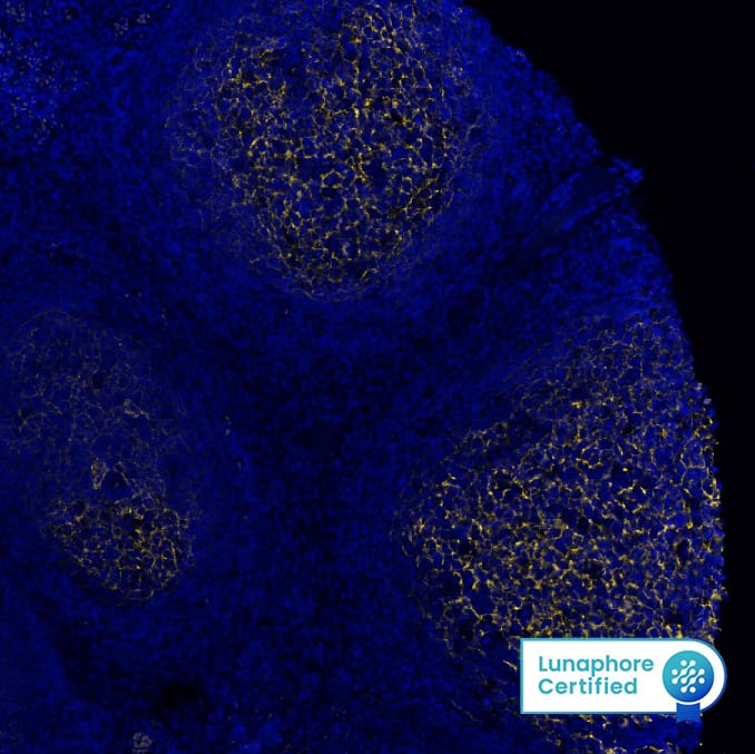 CD21 was detected in immersion fixed paraffin-embedded sections of human Tonsil using Rabbit Anti-Human CD21, Monoclonal Antibody (Catalog # NBP3-20354) at 1:2000 at 37° Celsius for 4 minutes. Before incubation with the primary antibody, tissue underwent an all-in-one dewaxing and antigen retrieval preprocessing using PreTreatment Module (PT Module) and Dewax and HIER Buffer H (pH 9; Epredia Catalog #TA-999-DHBH).Tissue was stained using the Alexa Fluor™ Plus 555 Goat anti-Rabbit IgG Secondary Antibody at 1:100 at 37 ° Celsius for 2 minutes. (Yellow; Lunaphore Catalog # DR555RB) and counterstained with DAPI (blue; Lunaphore Catalog # DR100). Specific staining was localized to the membrane. Protocol available in COMET™ Panel Builder. 