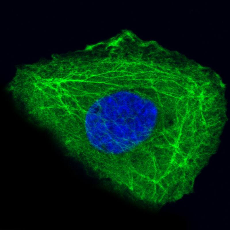 Staining in A-431 cell line with Anti-KRT14 monoclonal antibody, showing specific staining of intermediate filaments in green. Microtubule- and nuclear probes are visualized in red and blue respectively (where available).