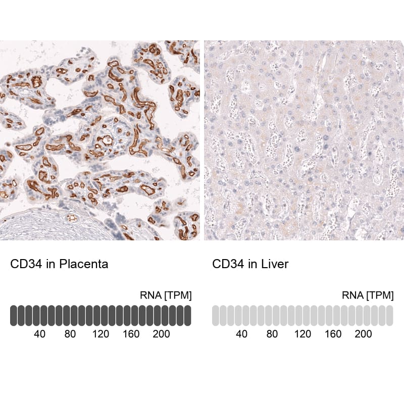 <b>Orthogonal Strategies Validation. </b>Analysis in human placenta and liver tissues. Corresponding RNA-seq data are presented for the same tissues.