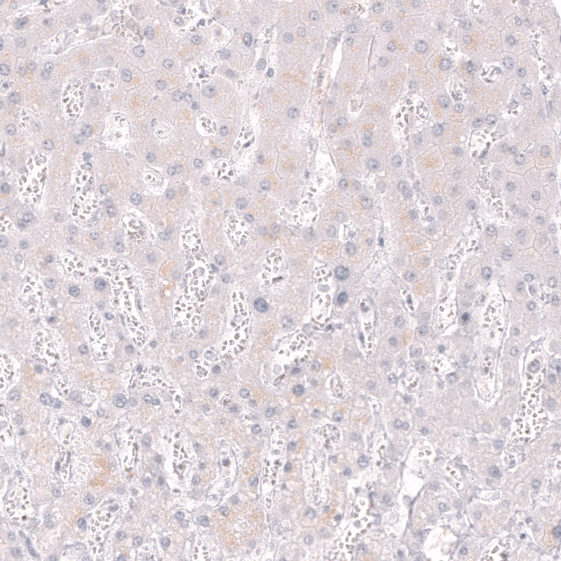 Staining of human liver shows no positivity in hepatocytes as expected.