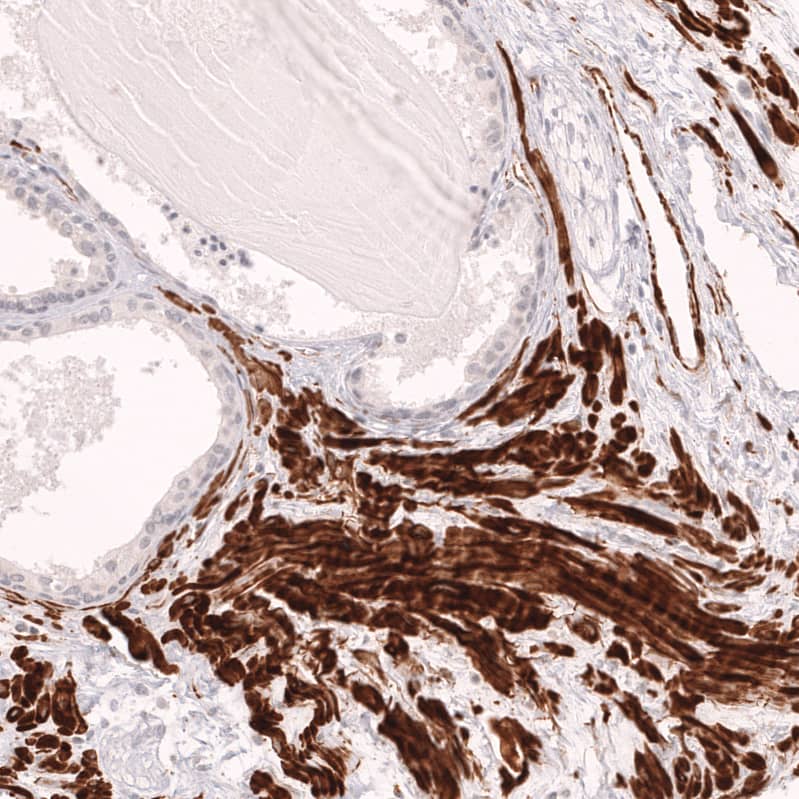 Staining of human prostate shows strong cytoplasmic positivity in smooth muscle cells.