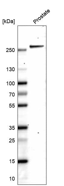 Western blot analysis in human prostate tissue.