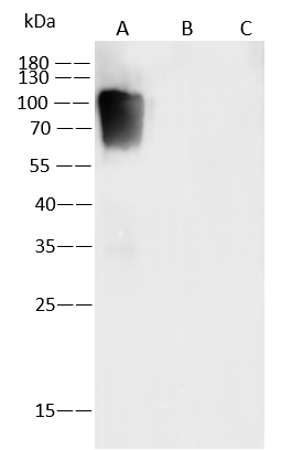 Western Blot: Varicella Zoster Virus Glycoprotein E Antibody (15) - Azide and BSA Free [NBP3-26891] - NBP3-26891 in 1 ug/mL. Sample: Recombinant Protein 10 ng Lane A: Varicella Zoster Virus Glycoprotein E Protein. Lane B: VZV (strain Oka vaccine) Glycoprotein B Protein. Lane C: VZV (strain Oka vaccine) gH & gL Heterodimer Protein. Secondary Goat Anti-Mouse IgG (H+L)/HRP at 1/10000 dilution. Developed using the ECL technique. Performed under reducing conditions.
