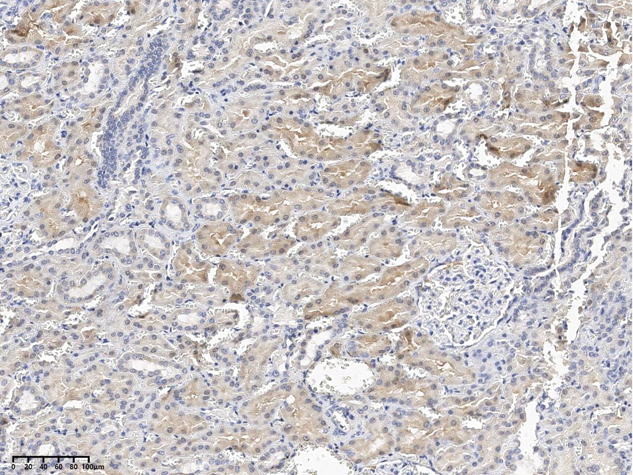 Immunohistochemistry-Paraffin SMDT1 Antibody - Azide and BSA Free