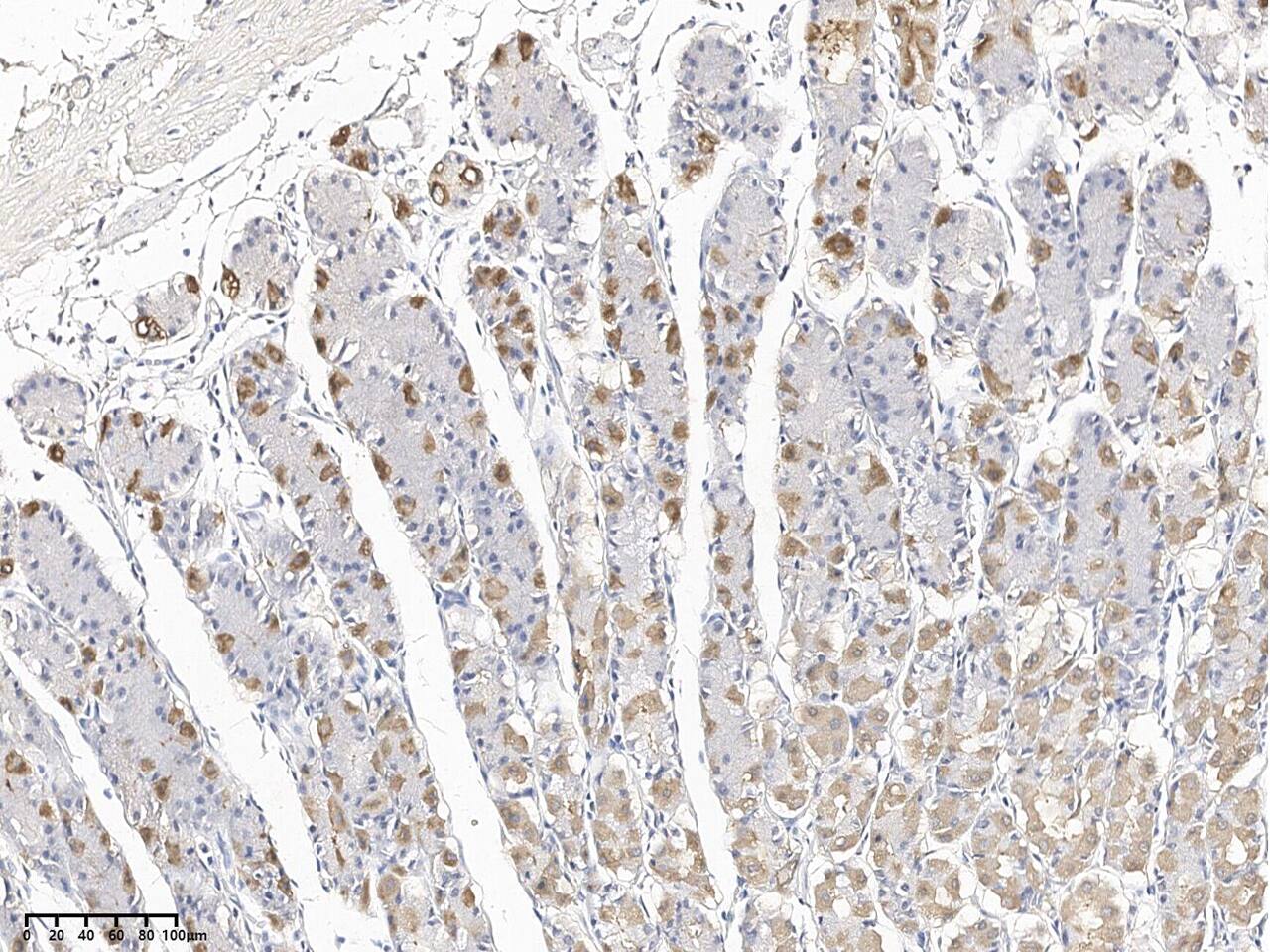 Immunohistochemistry-Paraffin SMDT1 Antibody - Azide and BSA Free