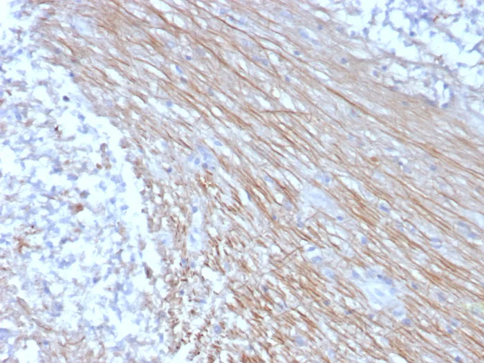 Formalin-fixed, paraffin-embedded human placenta stained with CD303 / CLEC4C Mouse Monoclonal Antibody (CLEC4C/3400). HIER: Tris/EDTA, pH9.0, 45min. 2°C: HRP-polymer, 30min. DAB, 5min.