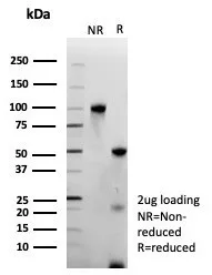 Formalin-fixed, paraffin-embedded human prostate stained with ERG Antibody (ERG/9122R) - Azide and BSA Free at 2ug/ml. HIER: Tris/EDTA pH 9; 95°C/45min. 2°CAb: HRP-Polymer:30mins; DAB: 5min.