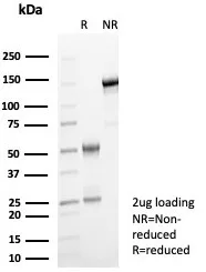 IHC analysis of formalin-fixed, paraffin-embedded human lymph node. GBP1 Antibody (GBP1/7617) - Azide and BSA Free. Inset: PBS instead of primary antibody; secondary only negative control.