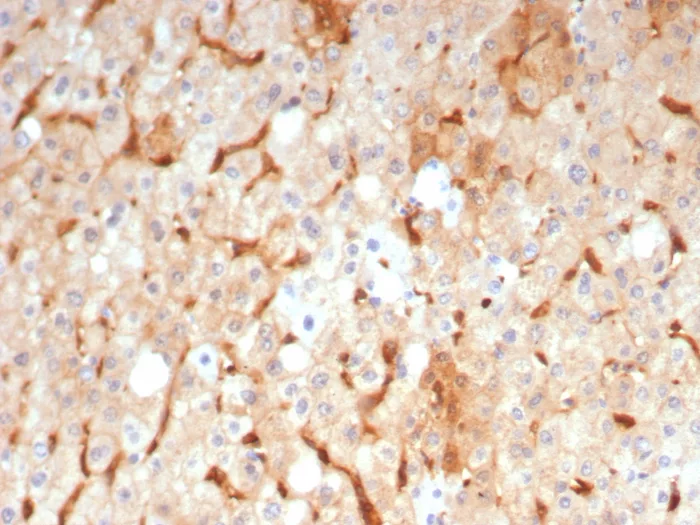 IHC analysis of formalin-fixed, paraffin-embedded human liver. GBP1 Antibody (GBP1/7617) - Azide and BSA Free. HIER: Tris/EDTA, pH9.0, 45min. 2°C: HRP-polymer, 30min. DAB, 5min.