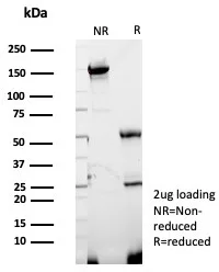 IHC analysis of formalin-fixed, paraffin-embedded human kidney. GBP1 Antibody (GBP1/7618) - Azide and BSA Free. Inset: PBS instead of primary antibody; secondary only negative control.