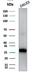 Western blot analysis of Daudi cell lysate using Haptoglobin Antibody (HP/4813) - Azide and BSA Free.