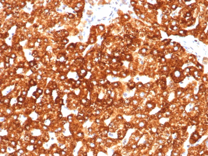 Formalin-fixed, paraffin-embedded human liver stained with Haptoglobin Antibody (HP/3838) - Azide and BSA Free. HIER: Tris/EDTA, pH9.0, 45min. 2°C: HRP-polymer, 30min. DAB, 5min.