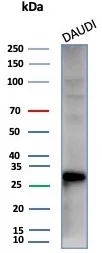 Western blot analysis of Daudi cell lysate using Haptoglobin Antibody (HP/3838) - Azide and BSA Free.