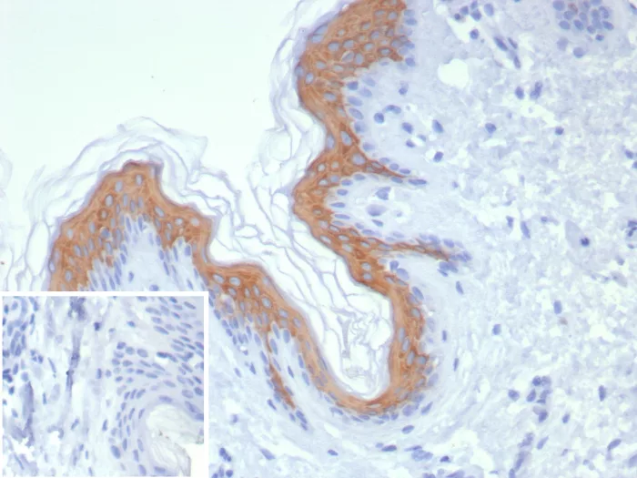 Formalin-fixed, paraffin-embedded human skin stained with Cytokeratin 1 Antibody (KRT1/8342R) - Azide and BSA Free. Inset: PBS instead of primary antibody; secondary only negative control.