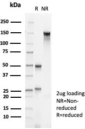 Formalin-fixed, paraffin-embedded human prostate stained with Cytokeratin 10 Antibody (KRT10/6961) - Azide and BSA Free. HIER: Tris/EDTA, pH9.0, 45min. 2°C: HRP-polymer, 30min. DAB, 5min.