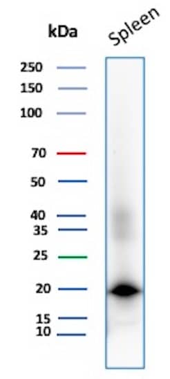 Western Blot Analysis of Human Spleen tissue lysate using Stathmin 1 Antibody (STMN1/8012) - Azide and BSA Free