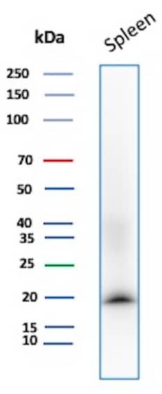 Western Blot Analysis of Human Spleen tissue lysate using Stathmin 1 Antibody (STMN1/8437) - Azide and BSA Free