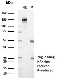 IHC analysis of formalin-fixed, paraffin-embedded human ovarian cancer. MxA/Mx1 Antibody (MX1/7529) - Azide and BSA Free. Inset: PBS instead of primary antibody; secondary only negative control.