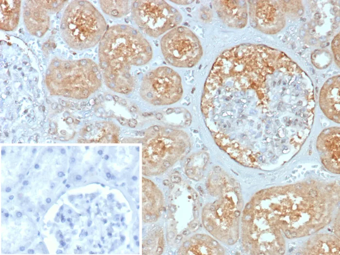 IHC analysis of formalin-fixed, paraffin-embedded human kidney. MxA/Mx1 Antibody (MX1/7529) - Azide and BSA Free. Inset: PBS instead of primary antibody; secondary only negative control.