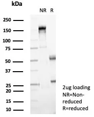 Formalin-fixed, paraffin-embedded human skin stained with NM23-H2/NME2 Antibody (NME2/4160) - Azide and BSA Free. HIER: Tris/EDTA, pH9.0, 45min. 2°C: HRP-polymer, 30min. DAB, 5min.