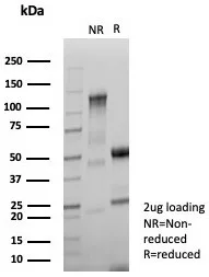 Formalin-fixed, paraffin-embedded human skin stained with NM23-H2/NME2 Antibody (NME2/6433) - Azide and BSA Free. Inset: PBS instead of primary antibody; secondary only negative control.