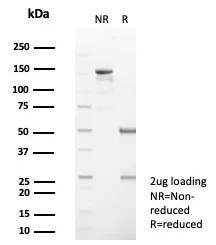 Formalin-fixed, paraffin-embedded human skin stained with Serpin B5/Maspin Antibody (SERPINB5/4971) - Azide and BSA Free. HIER: Tris/EDTA, pH9.0, 45min. 2°C: HRP-polymer, 30min. DAB, 5min.