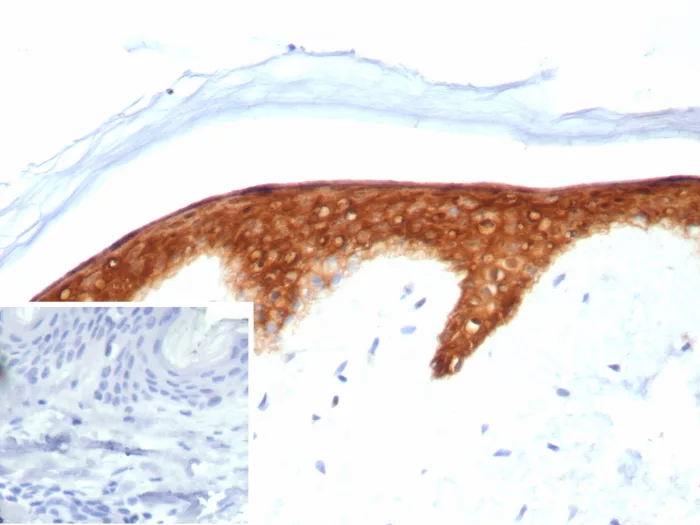 Formalin-fixed, paraffin-embedded human skin stained with Serpin B5/Maspin Antibody (SERPINB5/4974) - Azide and BSA Free. Inset: PBS instead of primary antibody; secondary only negative control.