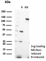 Formalin-fixed, paraffin-embedded human kidney stained with Parvalbumin alpha Antibody (PVALB/7601) - Azide and BSA Free. Inset: PBS instead of primary antibody; secondary only negative control.