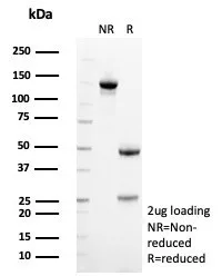Formalin-fixed, paraffin-embedded human heart stained with SDHA Antibody (SDHA/7492) - Azide and BSA Free. Inset: PBS instead of primary antibody; secondary only negative control.