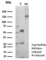 Formalin-fixed, paraffin-embedded human heart stained with SDHA Antibody (SDHA/7495) - Azide and BSA Free. HIER: Tris/EDTA, pH9.0, 45min. 2°C: HRP-polymer, 30min. DAB, 5min.