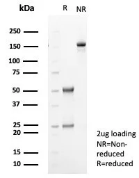 Formalin-fixed, paraffin-embedded human prostate carcinoma stained with TGF-beta 2 Antibody (TGFB2/1679) - Azide and BSA Free. Inset: PBS instead of primary antibody; secondary only negative control.
