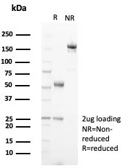 Formalin-fixed, paraffin-embedded human pancreas stained with TRPC6 Antibody (TRPC6/7671) - Azide and BSA Free. Inset: PBS instead of primary antibody; secondary only negative control.