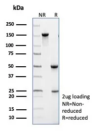 Analysis of Protein Array containing more than 19,000 full-length human proteins using TRAF-1 Antibody (TRAF1/3299) - Azide and BSA Free 