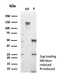 Analysis of Protein Array containing more than 19,000 full-length human proteins using TRAF-1 Antibody (TRAF1/3365) - Azide and BSA Free 