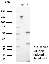 Formalin-fixed, paraffin-embedded human pancreas stained with TRPC6 Antibody (TRPC6/7672) - Azide and BSA Free. HIER: Tris/EDTA, pH9.0, 45min. 2°C: HRP-polymer, 30min. DAB, 5min.