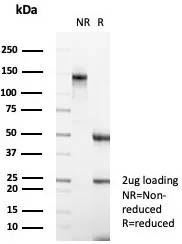 Formalin-fixed, paraffin-embedded human skeletal muscle stained with Carbonic Anhydrase III/CA3 Antibody (CA3/7883) - Azide and BSA Free. Inset: PBS instead of primary antibody; secondary only negative control.