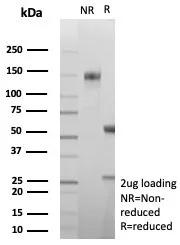 Formalin-fixed, paraffin-embedded human brain stained with Carbonic Anhydrase VIII/CA8 Antibody (CA8/8605R) - Azide and BSA Free. Inset: PBS instead of primary antibody; secondary only negative control.