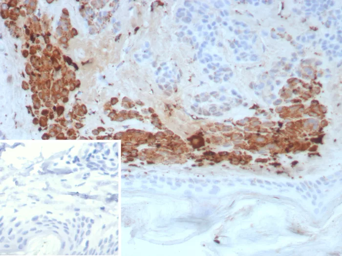 Formalin-fixed, paraffin-embedded human skin stained with Kallikrein 4/Prostase/EMSP1 Antibody (KLK4/8941) - Azide and BSA Free. HIER: Tris/EDTA, pH9.0, 45min. 2°C: HRP-polymer, 30min. DAB, 5min.