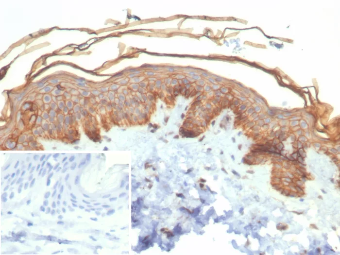 Formalin-fixed, paraffin-embedded human skin stained with S100A16 Antibody (S100A16/7411) - Azide and BSA Free. HIER: Tris/EDTA, pH9.0, 45min. 2°C: HRP-polymer, 30min. DAB, 5min.