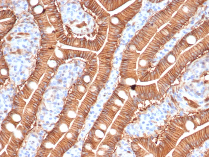 Formalin-fixed, paraffin-embedded human skin stained with S100A16 Antibody (S100A16/7412) - Azide and BSA Free. Inset: PBS instead of primary antibody; secondary only negative control.