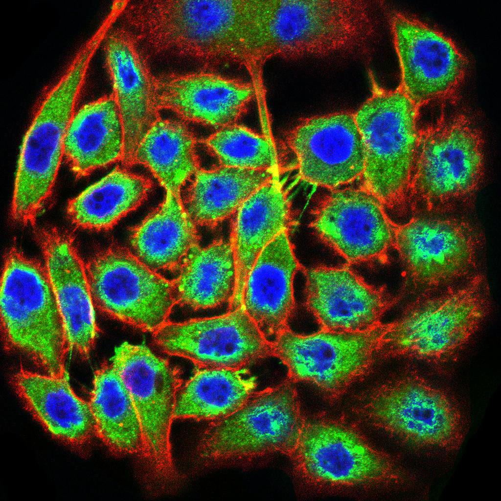 Immunocytochemistry/Immunofluorescence: RNA polymerase I termination factor Antibody (2F4D8) [NBP3-27122] - Analysis of MCF-7 cells using RNA polymerase I termination factor mouse mAb (green). Blue: DRAQ5 fluorescent DNA dye. Red: Actin filaments have been labeled with Alexa Fluor-555 phalloidin.