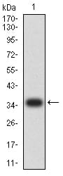 Western Blot: Ig Lambda C Domain/IGLC2 Antibody (5E12B9) [NBP3-27124] - Analysis using Ig Lambda C Domain/IGLC2 mAb against human Ig Lambda C Domain/IGLC2 (AA: 1-106) recombinant protein. (Expected MW is 36.8 kDa)