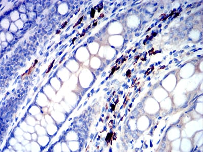 Immunohistochemistry: Ig Lambda C Domain/IGLC2 Antibody (5E12B9) [NBP3-27124] - Analysis of paraffin-embedded colon tissues using Ig Lambda C Domain/IGLC2 mouse mAb with DAB staining.